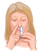 How to Use Nasal Sprays Properly