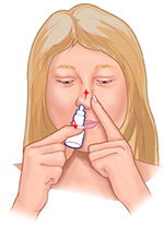 How to Use Nasal Sprays Properly